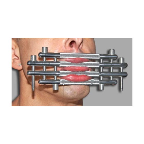 Baillon Block Lips Métal