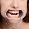 Baillon RETRACTOR Bouche